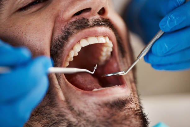 Best Tooth Extraction  in Lahoma City, OK